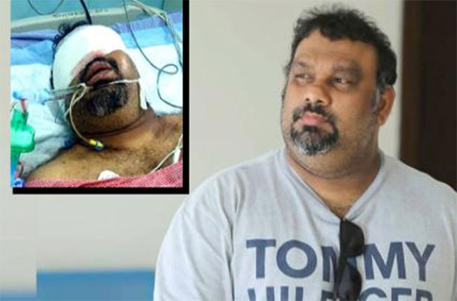kathi mahesh lost his left eye social media spreads news 