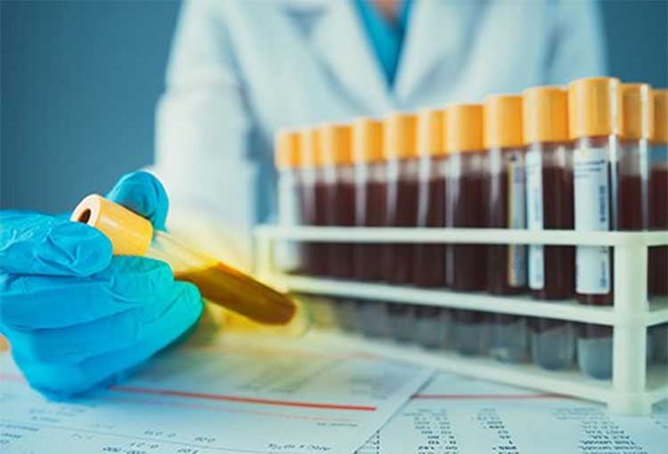 do you know about gold blood type 