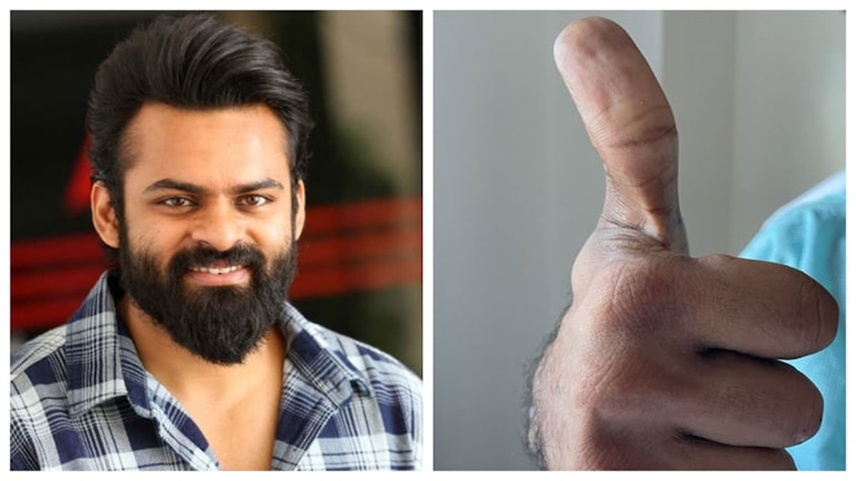 sai dharam tej is recovering soon to go for movie shooting
