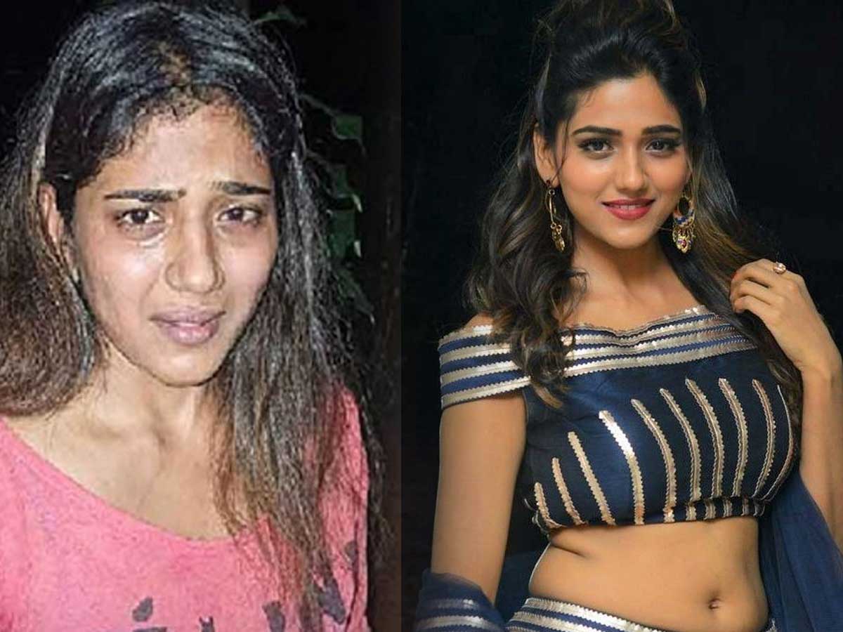 attack on Actress Chaurasia mystery solved police arrested the man 