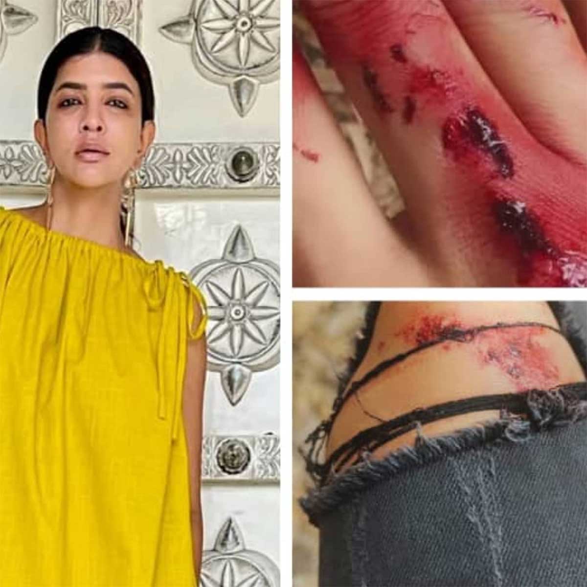 Manchu Lakshmi posted her injured photos netizen angry on her 