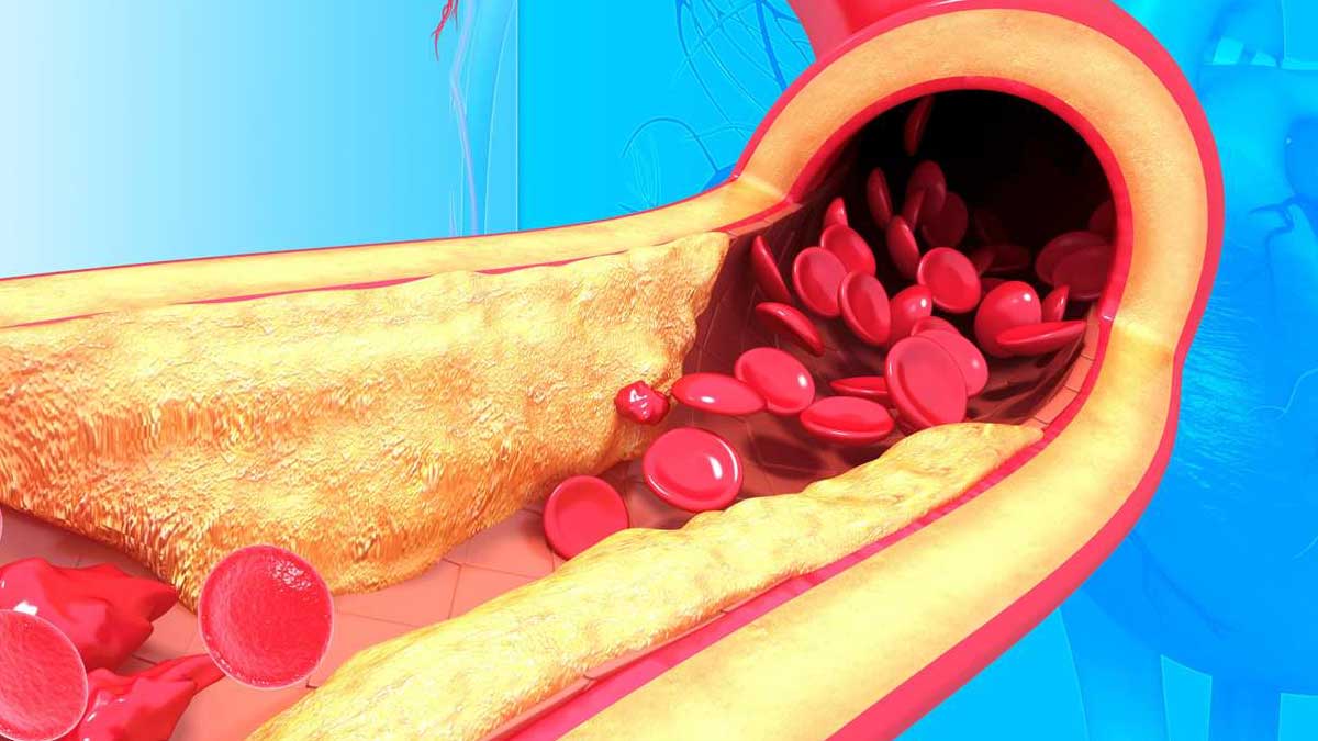 take these foods daily to reduce cholesterol 