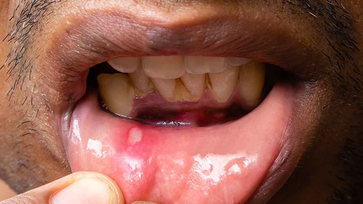 if you have these symptoms in mouth then beware 
